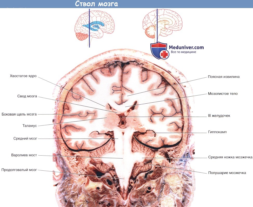 Анатомия и топография ствола мозга