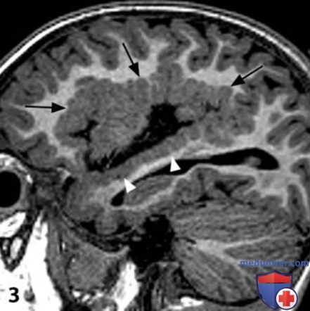 ��� �������� ������������ �������������� ��������������