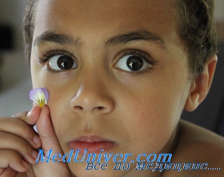 Пульс терапия метипредом при нефротическом синдроме в детстве thumbnail