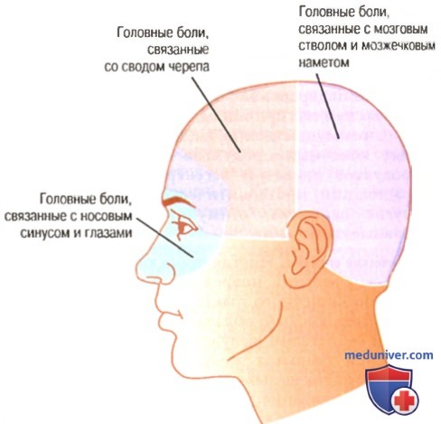 Типы внутричерепной головной боли. Головная боль при запоре