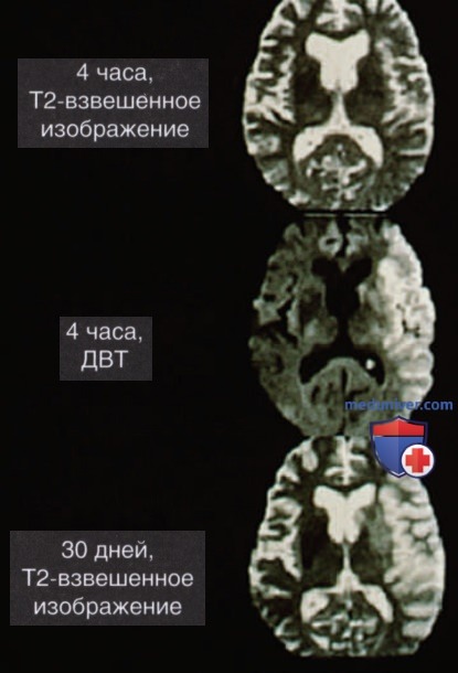 ����������� ������� ��������� �����