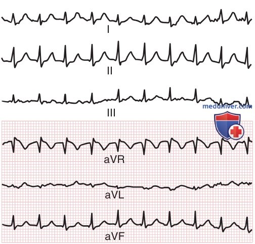 ��������������� ����������� (���)