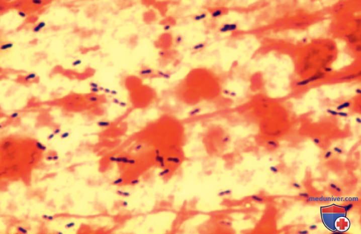 �������������� �������� (S. pneumoniae)