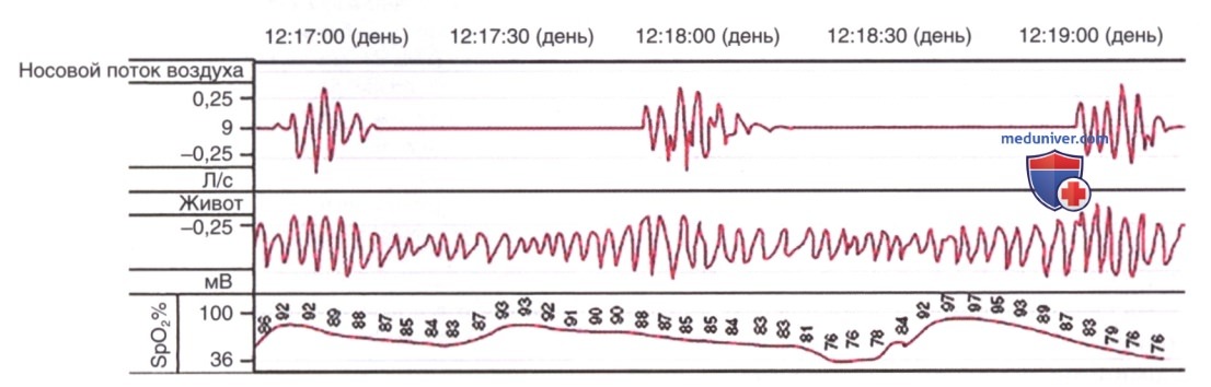 ������������ ���