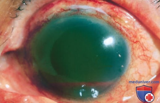 ������� ����������� �����