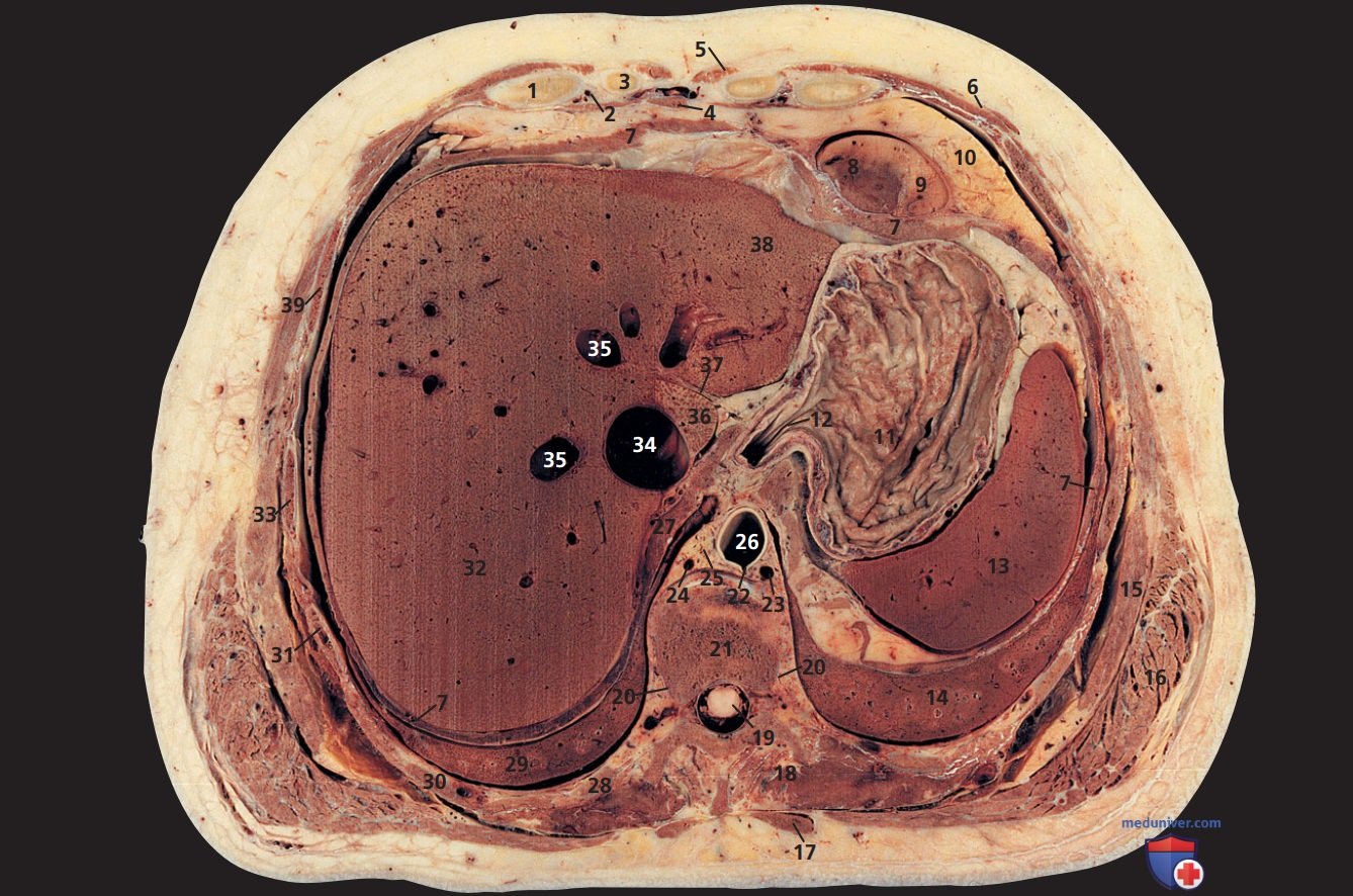 Анатомия аксиального среза живота через тело десятого грудного позвонка (Th10) и мечевидный отросток грудины