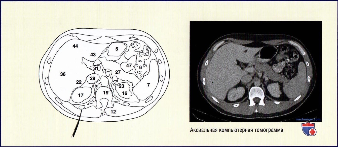 Анатомия аксиального среза живота через тело двенадцатого грудного позвонка (Th12)