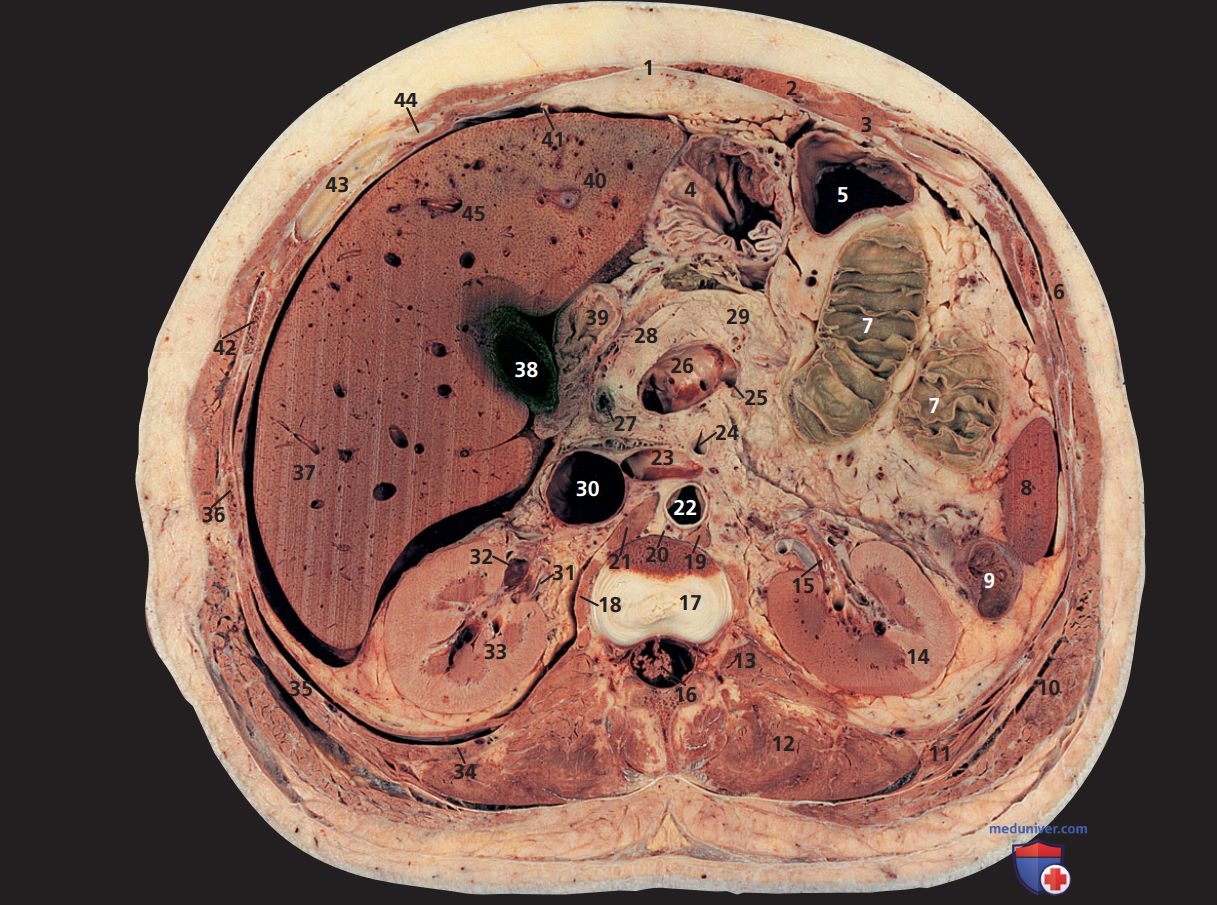 Анатомия аксиального среза живота через межпозвонковый диск двенадцатого грудного и первого поясничного позвонков (Th12-L1)