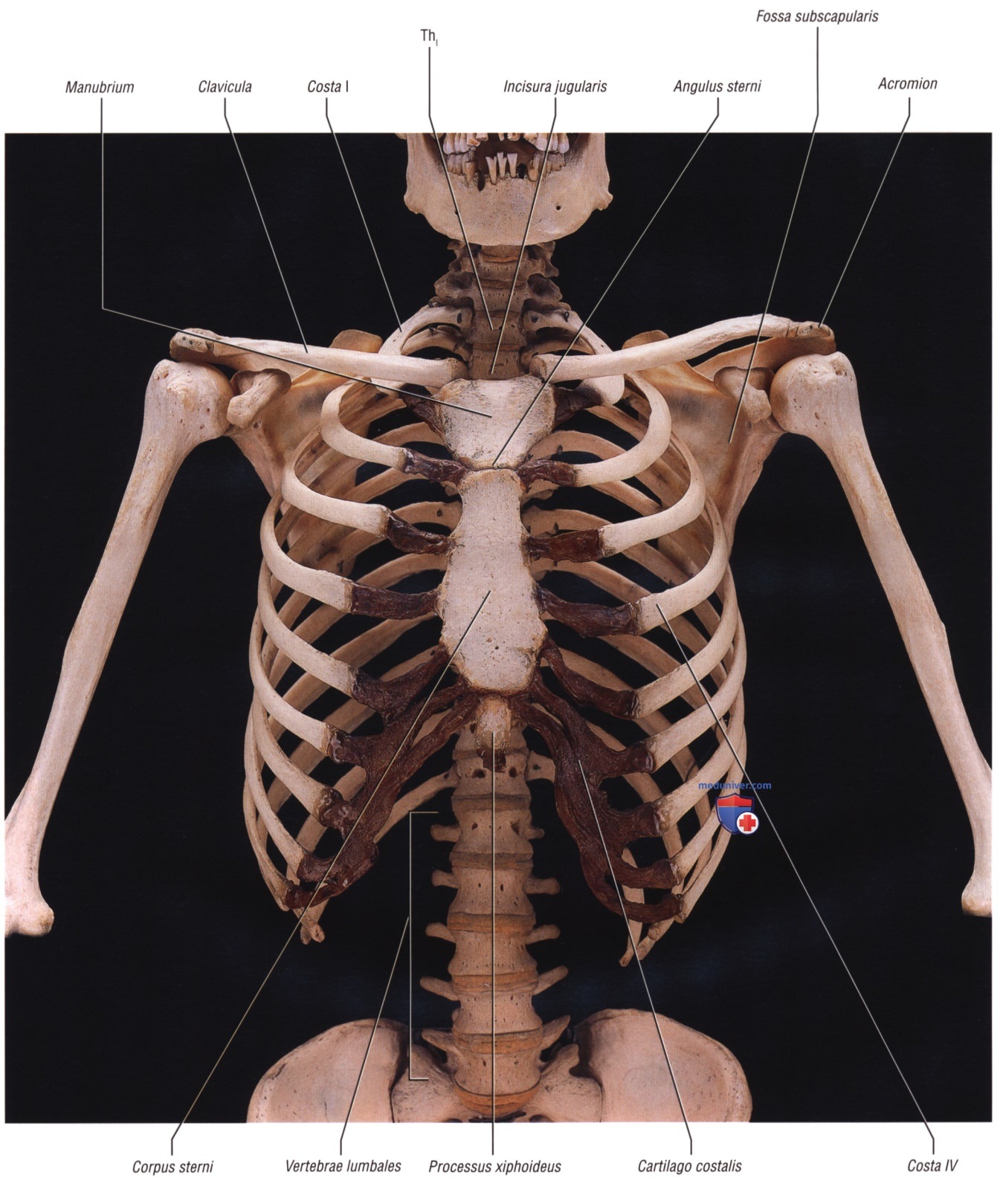 ������