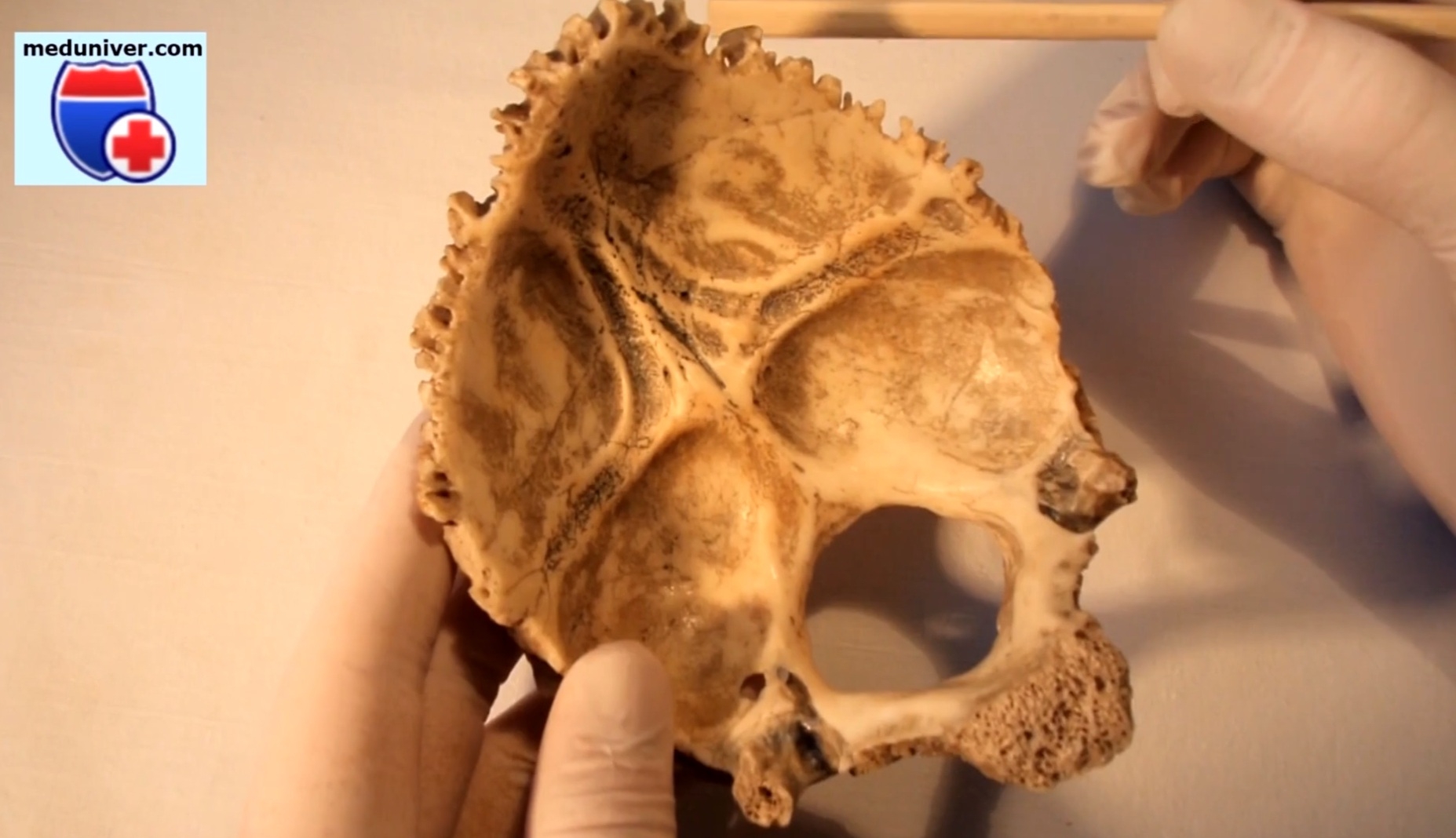 Видео нормальной анатомии затылочной кости