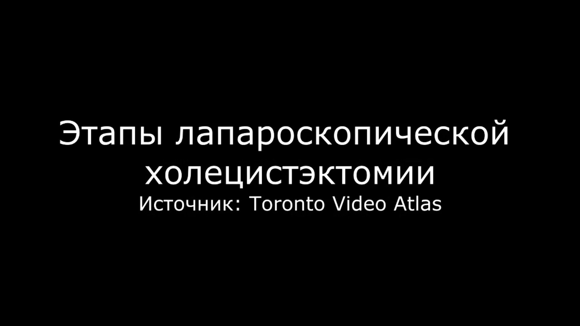 Ход операции лапароскопического удаления желчного пузыря - холецистэктомии