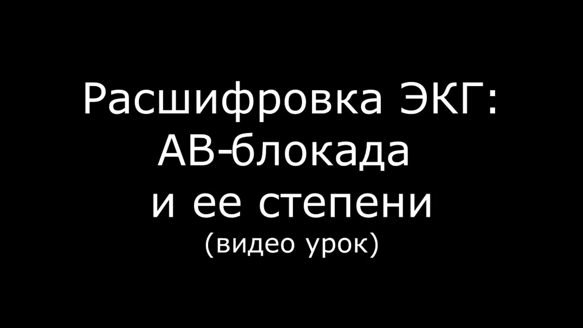 Видео АВ-блокады и ее степеней на ЭКГ