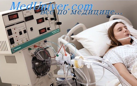 ИВЛ - искусственная вентиляция легких при респираторной поддержке