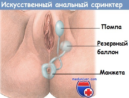 Розовый анус девушки (58 фото) - порно насадовой3.рф