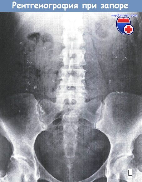 rentgenografia pri zapore