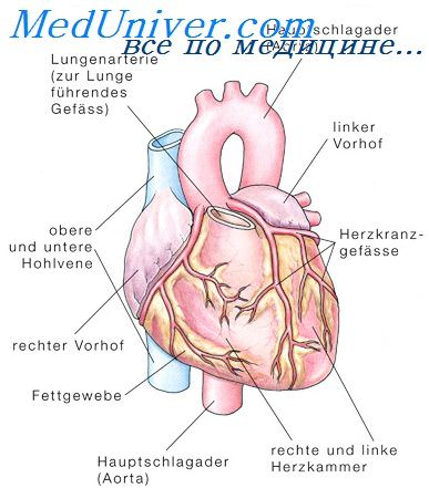 инфаркт миокарда