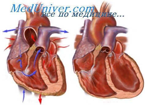 Укажите виды сердечной недостаточности кровообращения thumbnail