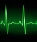 ЭКГ аритмии сердца