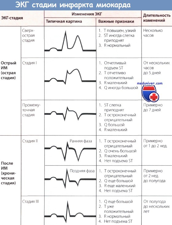 Какие изменения при q-инфаркте являются значительными