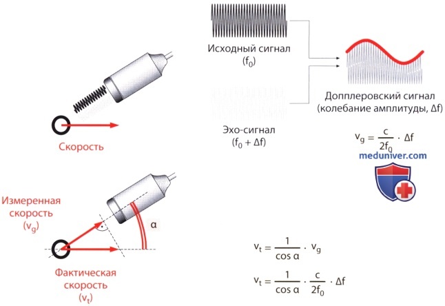 Технические основы импульсно-волновой спектральной допплер-эхокардиографии