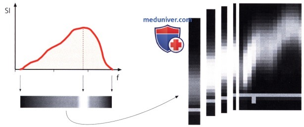 Технические основы импульсно-волновой спектральной допплер-эхокардиографии