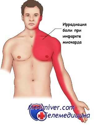 http://meduniver.com/Medical/cardiologia/Img/infarkt_miokarda_letom-3.jpg