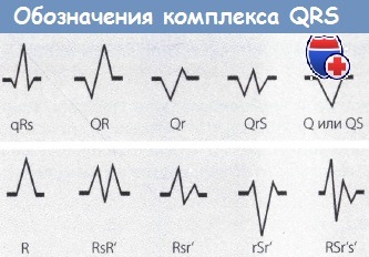 Обозначения комплекса QRS