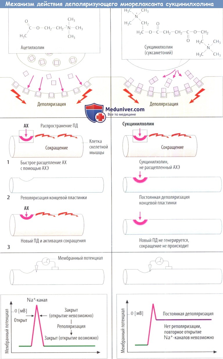 Механизм действия деполяризующего миорелаксанта сукцинилхолина