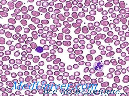 Мазок крови при железодефицитной анемии