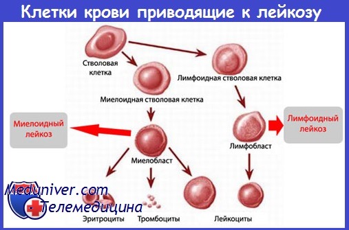 Механизмы анемии при лейкозе thumbnail