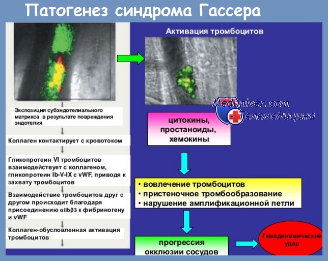 Синдром артериальной гипертензии при тромбоцитопении thumbnail