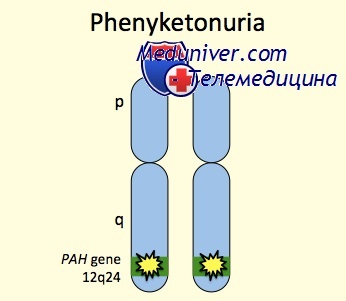 Генетика фенилкетонурии (ФКУ)