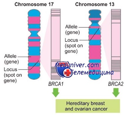 Диагностика мутации в генах BRCA1 и BRCA2