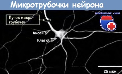 mikrotrubochki neirona