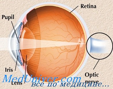 тетраэтилсвинцовая глаукома