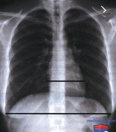Для чего нужен анализ качества рентгенограммы?