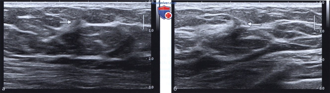 ���������� ����������� �������� ������ ��� ���