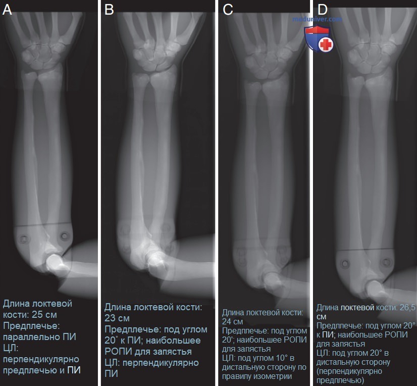 ������������ �� ��������� ������������ ������������ ���� (��), ��������� ����� ���� � ��������� ����������� (��) ��� �������� (������������) ��������������