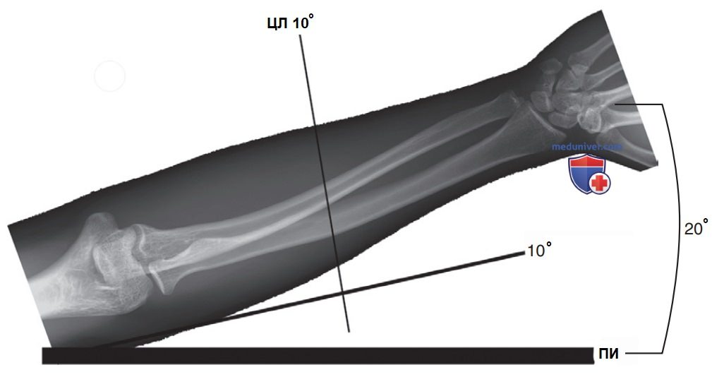 ������������ �� ��������� ������������ ������������ ���� (��), ��������� ����� ���� � ��������� ����������� (��) ��� �������� (������������) ��������������