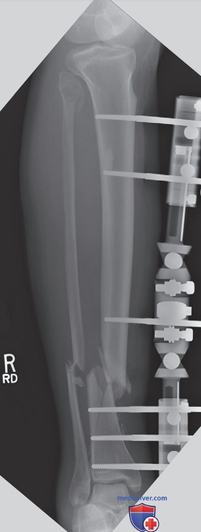 ������������ �� ��������� ������������ ������������ ���� (��), ��������� ����� ���� � ��������� ����������� (��) ��� �������� (������������) ��������������