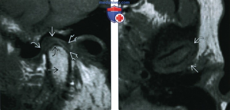 Лучевая анатомия, методы исследования верхней челюсти, нижней челюсти, височно-нижнечелюстного сустава