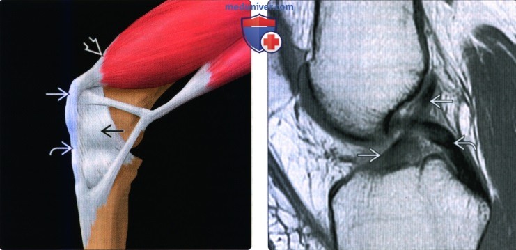 Введение в лучевую диагностику травм коленного сустава