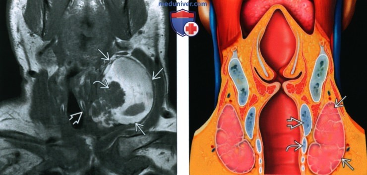 Введение в лучевую диагностику висцерального пространства: лучевая анатомия, методы исследования
