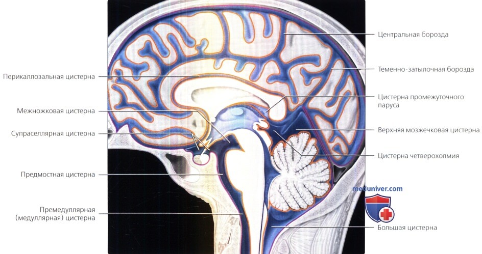 Цистерны мозга расширены. Цистерны паутинной оболочки головного мозга. Расширение цистерны вены Галена. Цистерна вены Галена анатомия. Базальные цистерны головного мозга кт анатомия.