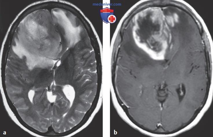 ��� ������� ������������� ������������