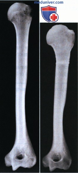 Идентификация анатомических структур на рентгенограмме при оценке ее качества