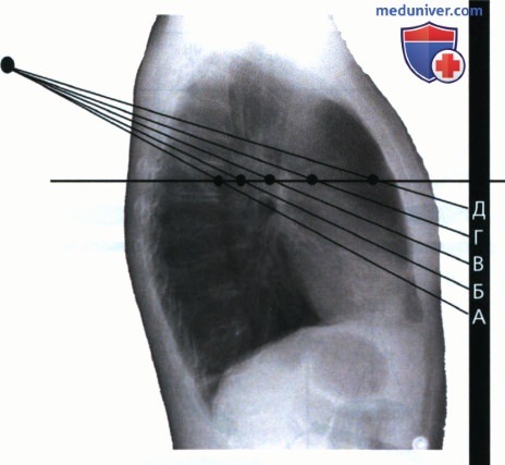 Идентификация анатомических структур на рентгенограмме при оценке ее качества