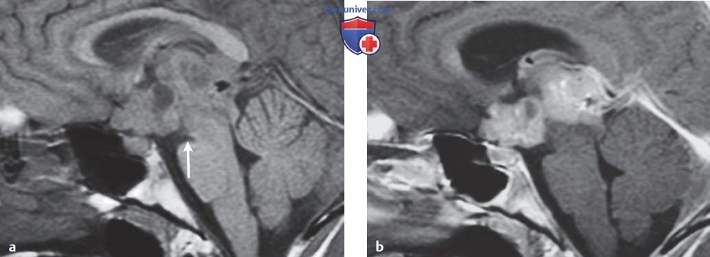 ��� ������� ���������