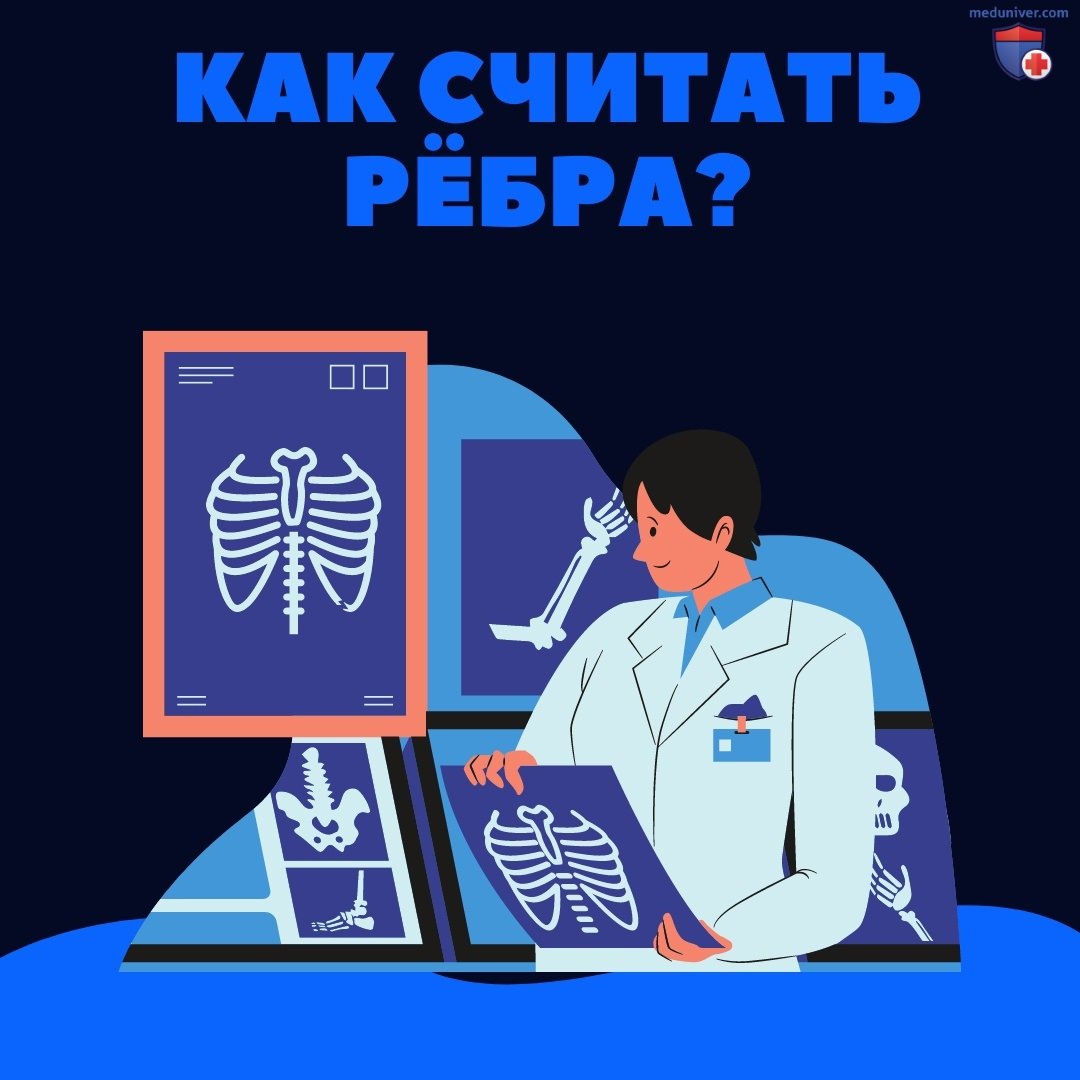 Как считать ребра на рентгенограмме грудной клетки