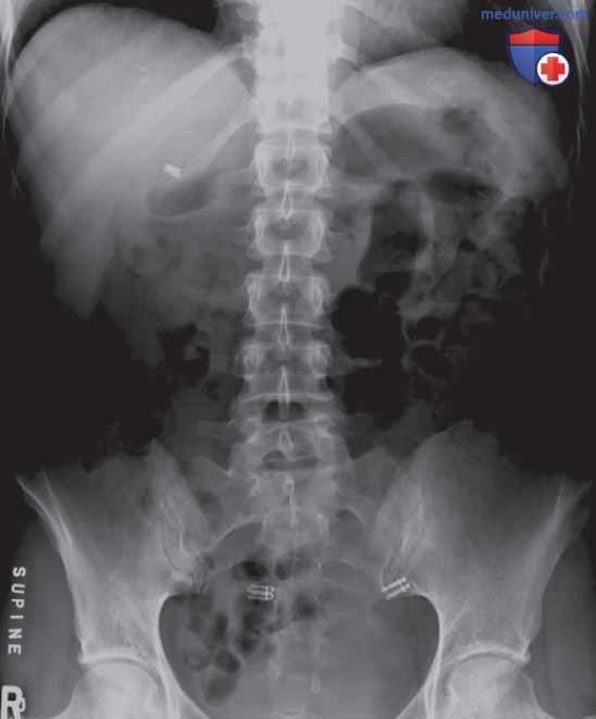 ������������ �� ������������� ��������������� �������� ���������� ��� �������� (������������) ��������������